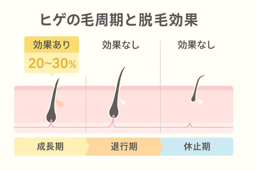ヒゲの毛周期を解説する図。成長期・退行期・休止期の3段階を横並びで表示し、成長期の毛は「効果あり20〜30%」、退行期・休止期の毛は「効果なし」と示している。