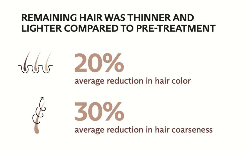 スプレンダーX施術後に毛の色が約20％薄くなり毛の太さが約30％細くなる傾向を示した研究結果